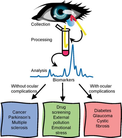 Tear analysis as the next routine body fluid test 